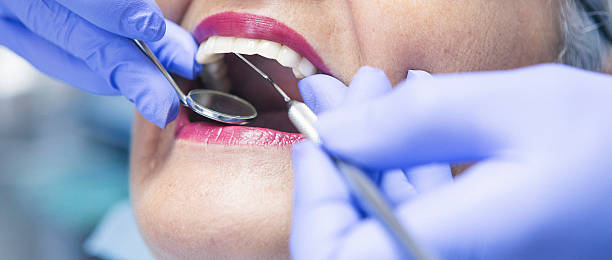 Best Emergency Tooth Extraction in Flint, MI